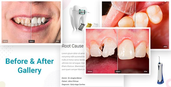 Dental Clinic - Dentist WordPress Theme